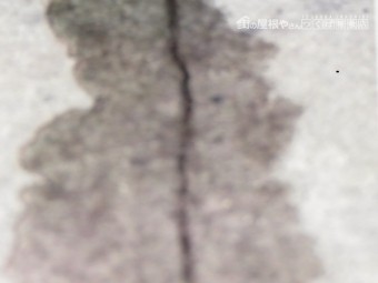 コロニアルひび割れ修復